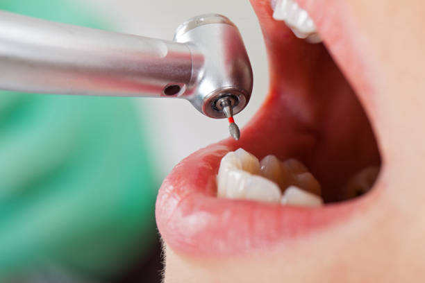 Best Weekend Emergency Dentist in Creston, IA